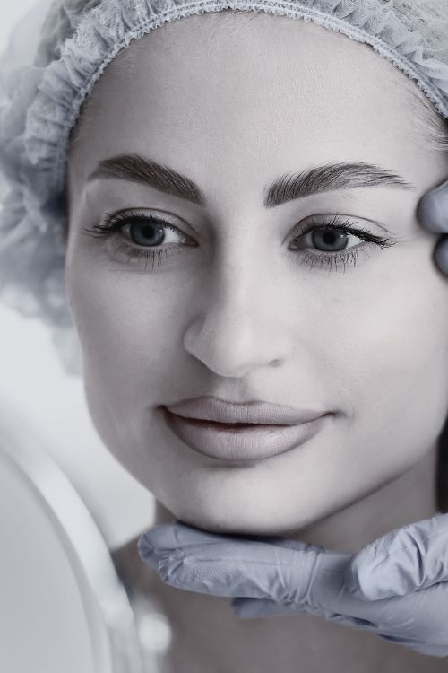 Blefaroplastia cin cirugía en Madrid