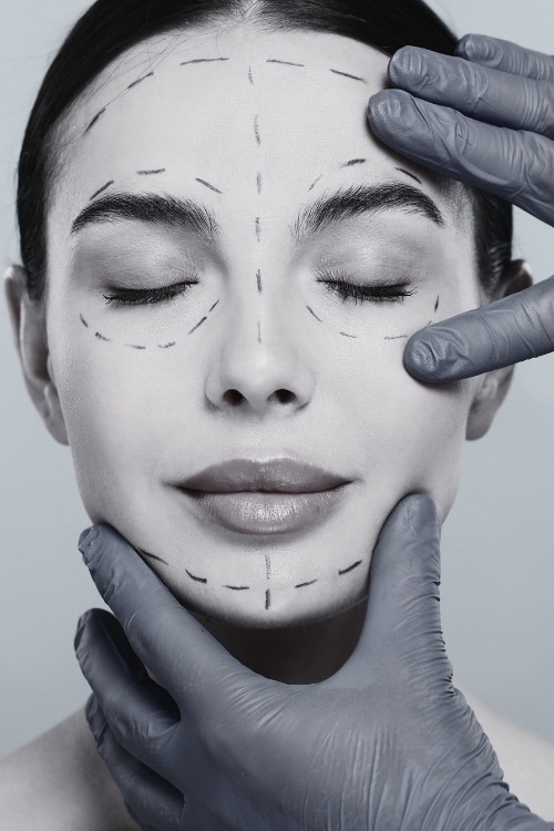 Planificación de rinoplastia en ENEA